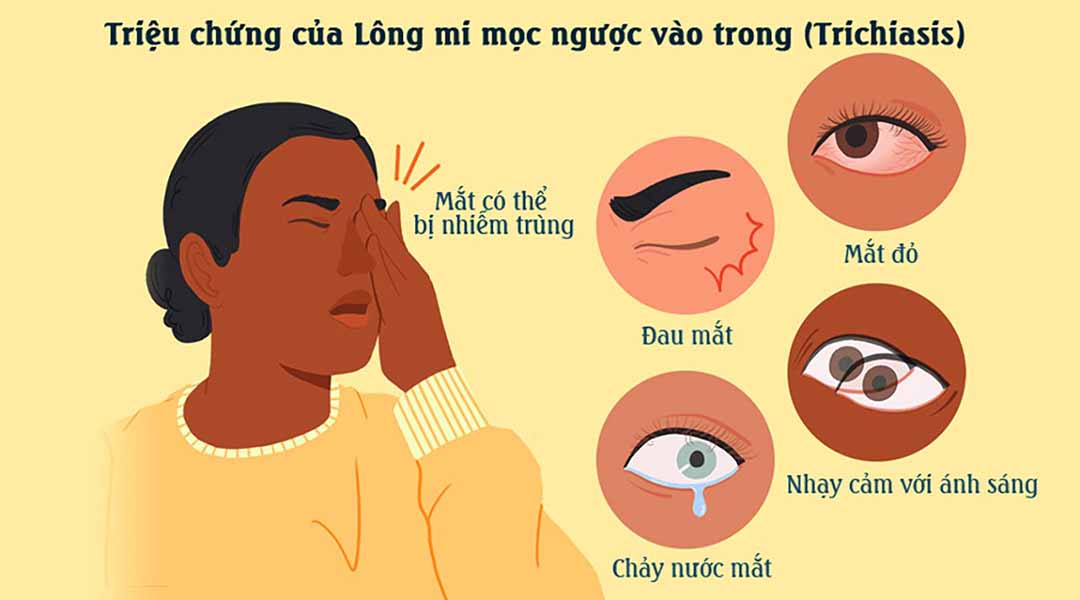 Triệu chứng gây ra làm ảnh hưởng đến thị lực của bạn.