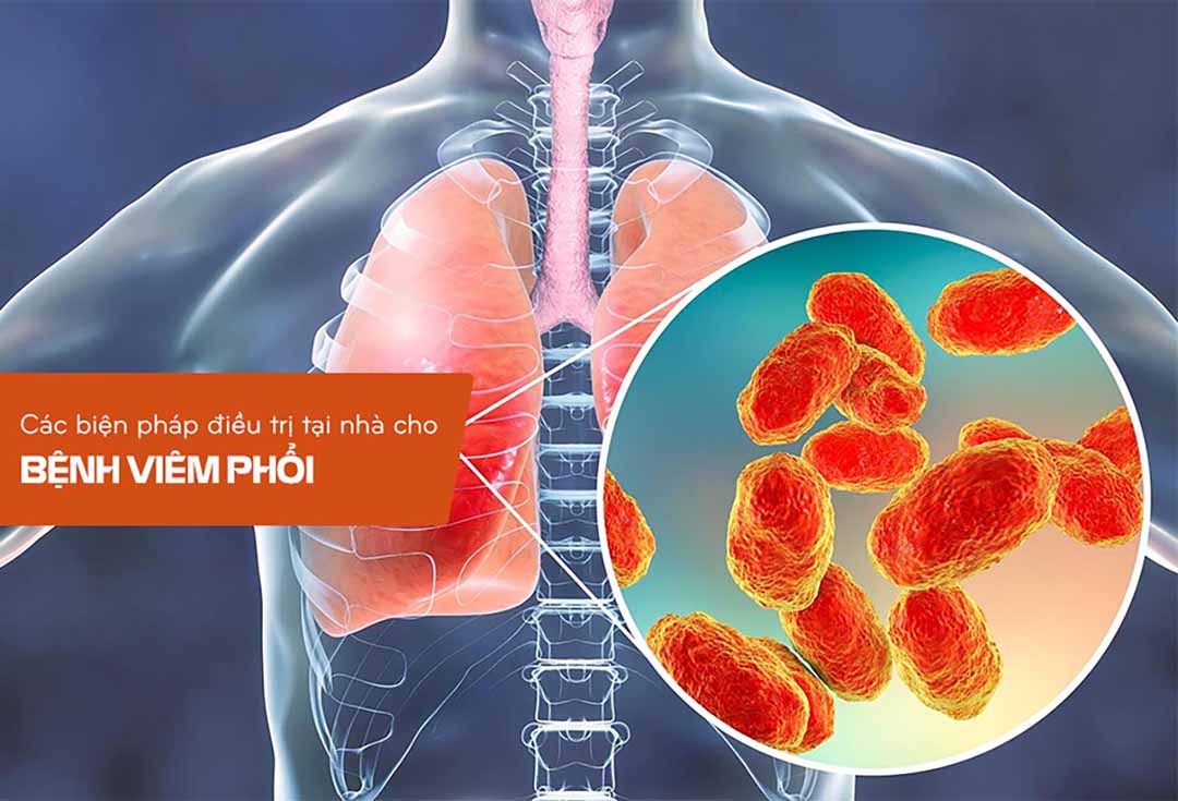 Các biện pháp điều trị tại nhà cho bệnh viêm phổi