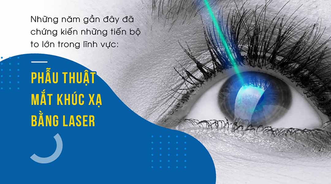 Các loại phẫu thuật mắt khúc xạ bằng laser