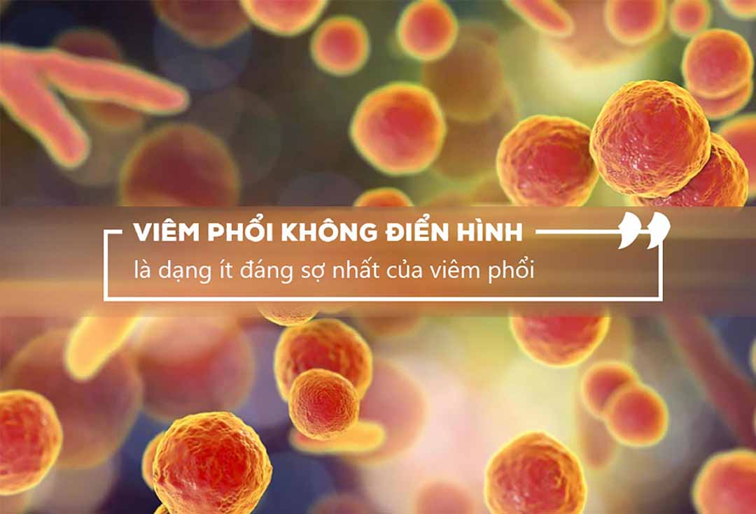 Viêm phổi không điển hình là gì?