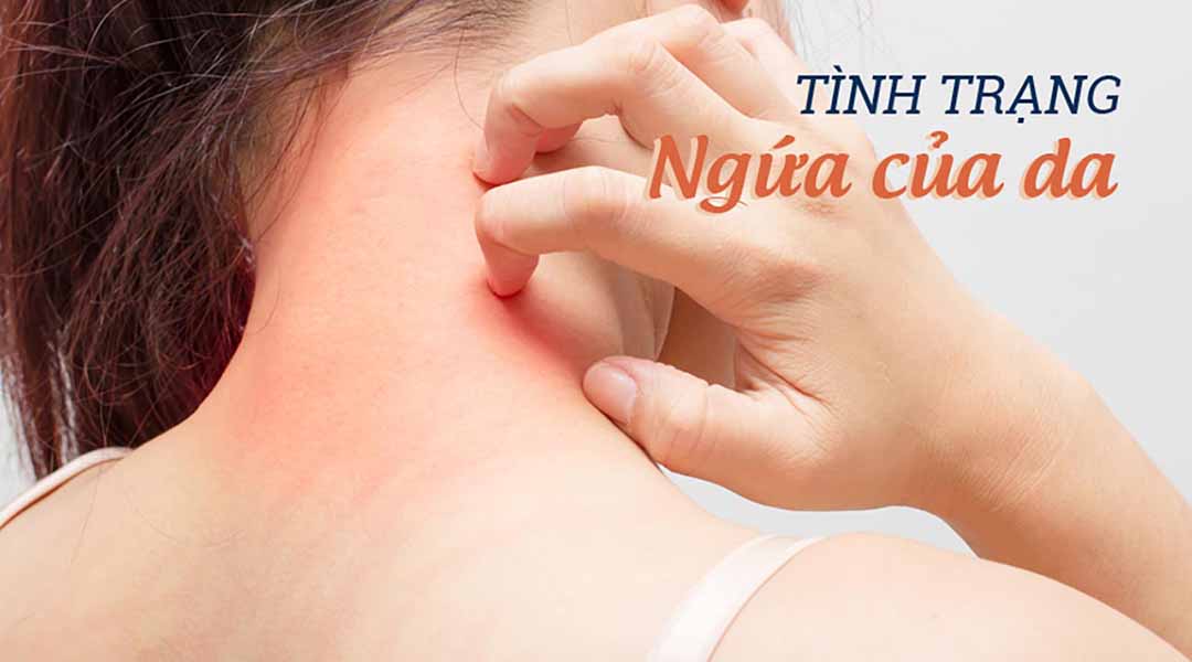 Tình trạng ngứa của da