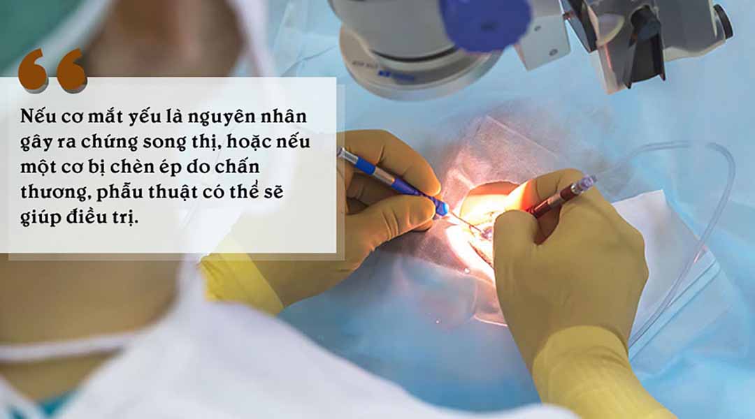 Phẫu thuật cho tình trạng song thị có thể xem là phương pháp hiệu quả nhất.