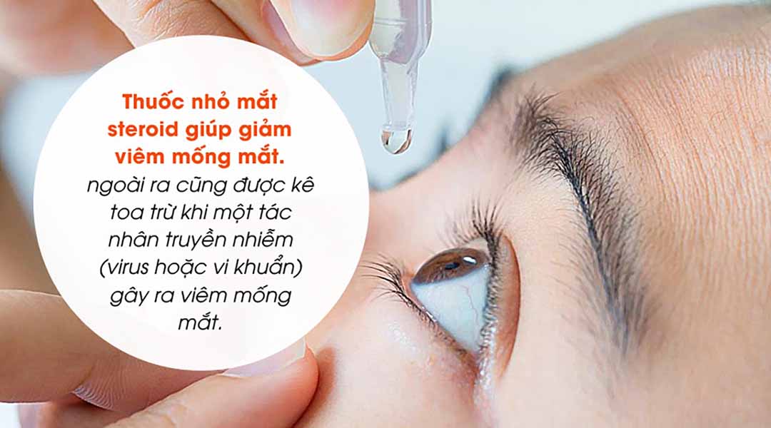 Thời gian điều trị phụ thuộc vào mức độ nghiêm trọng của mắt và tính hiệu quả của điều trị đó. 
