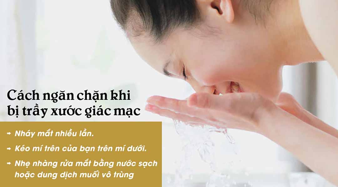 Thực hiện ngay các hướng dẫn như trên để ngăn chặn trầy giác mạc nghiêm trọng thêm.