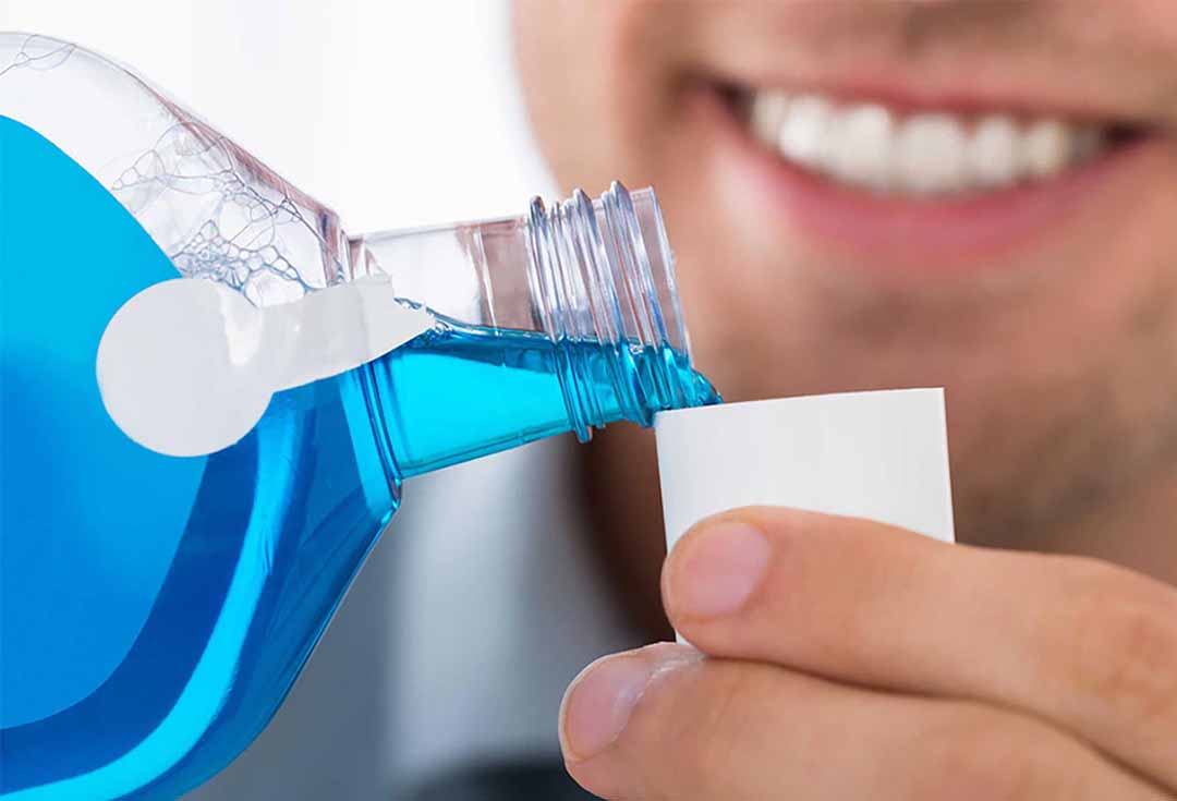 Sử dụng nước súc miệng (có thuốc) để điều trị tưa miệng.