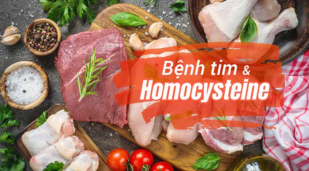 Bệnh tim và Homocysteine