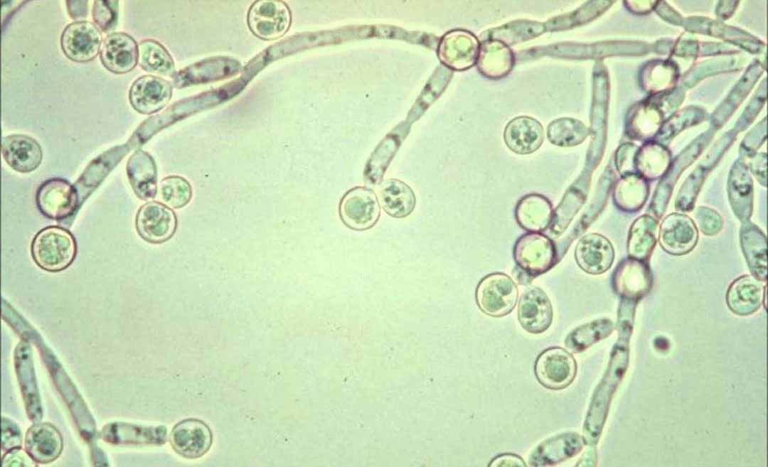 Sinh vật xâm nhập gây hại như virus, vi khuẩn, nấm và cân bằng sự duy trì giữa vi khuẩn có lợi.