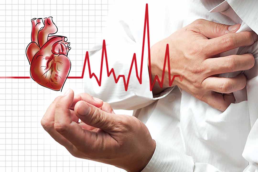Bệnh nhân tim mạch được khuyến cáo đi lại mỗi 20 phút để kéo dài tuổi thọ