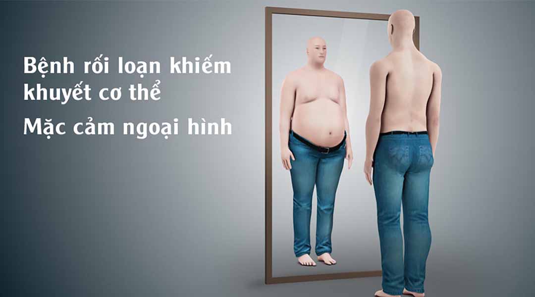 Bệnh rối loạn khiếm khuyết cơ thể - mặc cảm ngoại hình