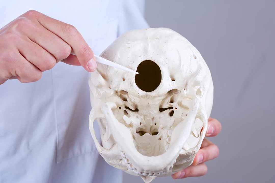 Tình trạng trên xảy ra khi một phần của hộp sọ nhỏ bất thường hoặc bị biến dạng.
