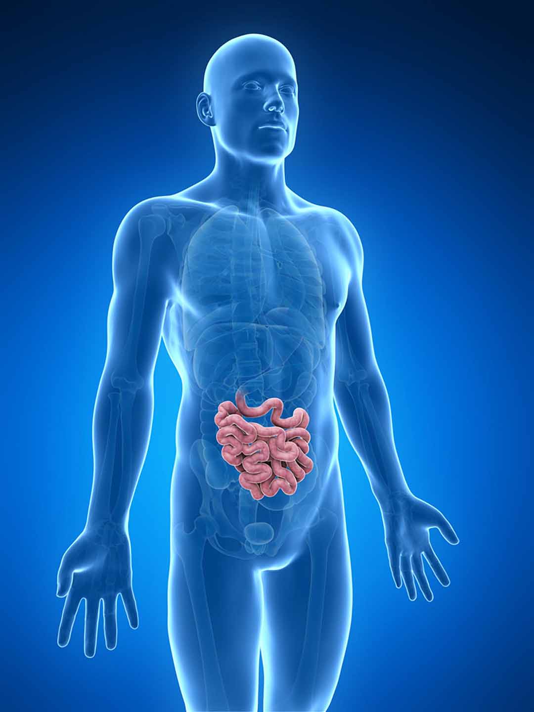 Một căn bệnh hiếm gặp do các tế bào trong các mô của ruột non thay đổi.
