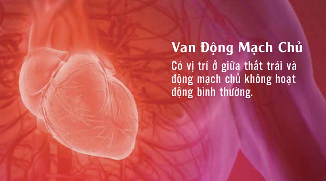  Van Động Mạch Chủ 