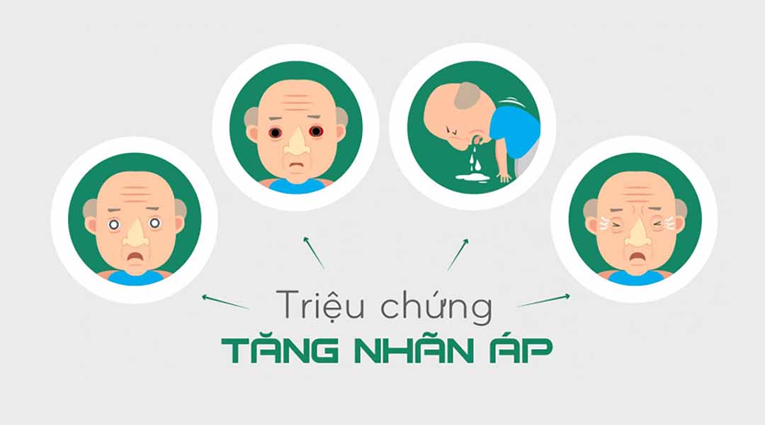 Triệu chứng tăng nhãn áp là gì?