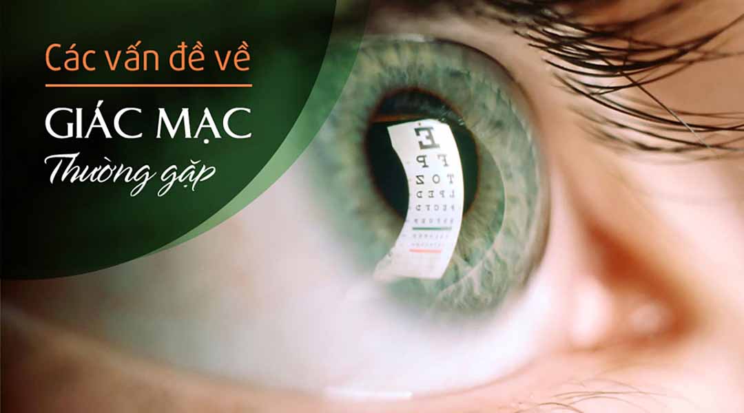 Các vấn đề về giác mạc thường gặp