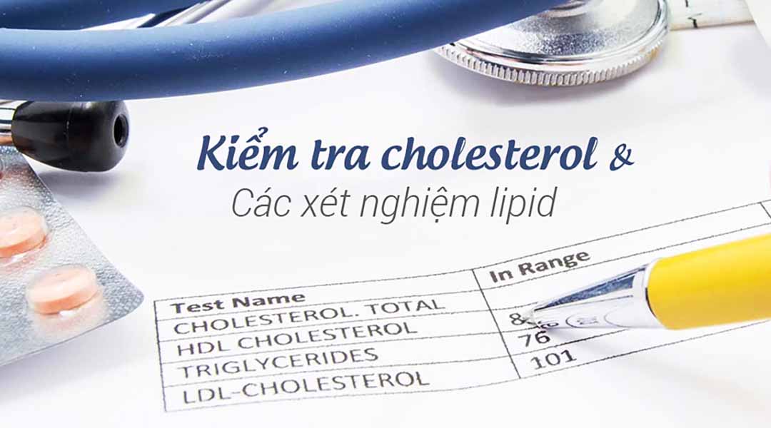 Kiểm tra cholesterol và các xét nghiệm lipid cơ bản