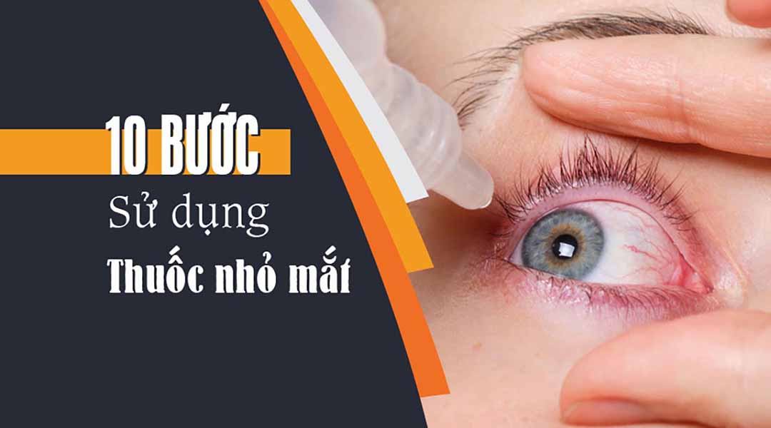 10 bước giúp bạn sử dụng thuốc nhỏ mắt đúng cách