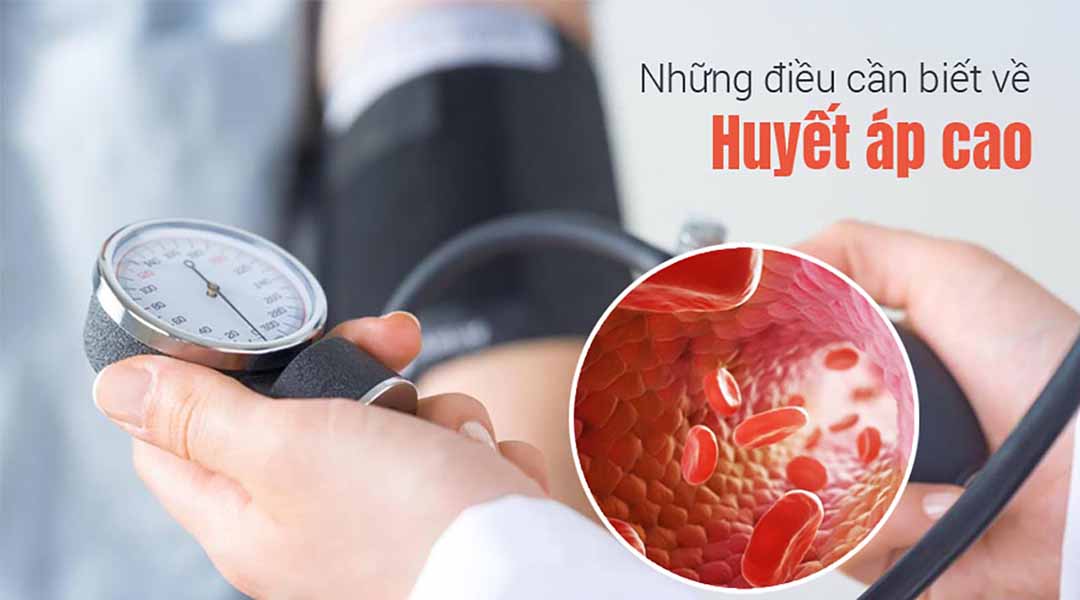 Những điều cần biết về huyết áp cao