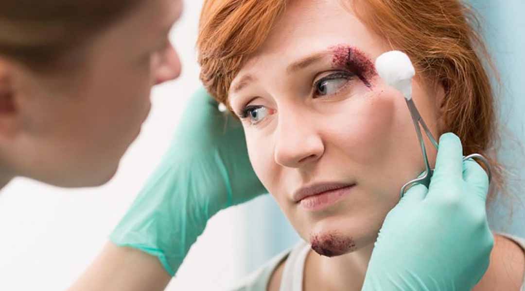 Bất kỳ triệu chứng nào gây tổn thương nghiêm trọng mắt, hãy đến gặp bác sĩ ngay.