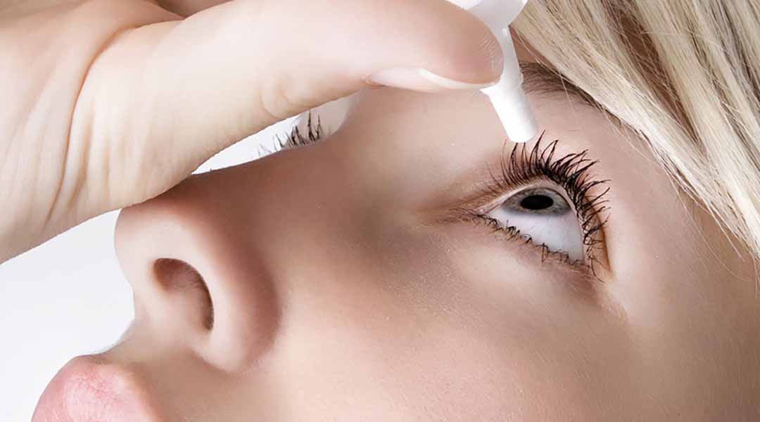 Điều trị thông thường là dùng thuốc nhỏ mắt trước, sau đến đeo kính hoặc kính áp tròng.