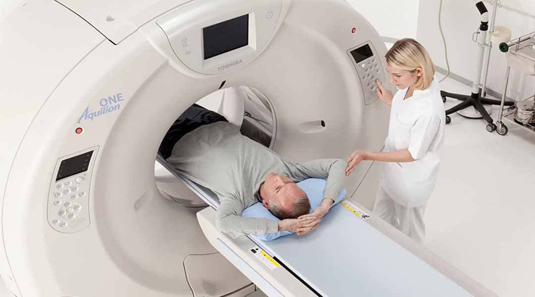 Chụp cắt lớp vi tính (CT - Computerized tomography).