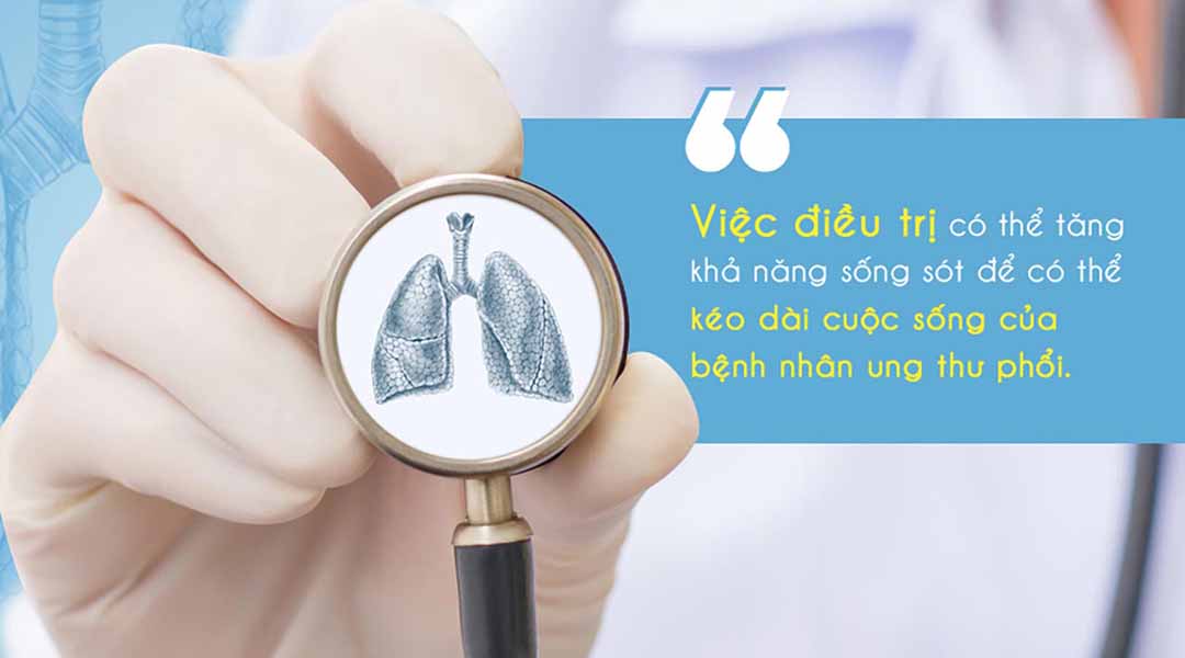 Các phương pháp điều trị có thể tăng tỷ lệ sống sót của bệnh ung thư phổi