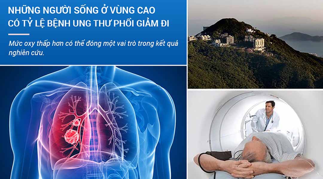 Người sinh sống ở vùng trên cao thì tỷ lệ ung thư phổi dường như giảm