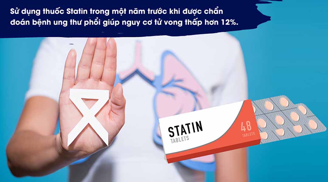 Statin có thể giúp giảm nguy cơ tử vong do ung thư phổi?