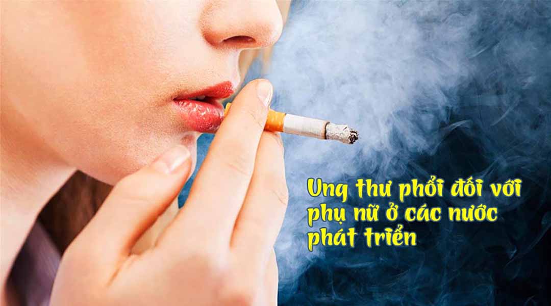 Ung thư phổi đối với phụ nữ ở các nước phát triển