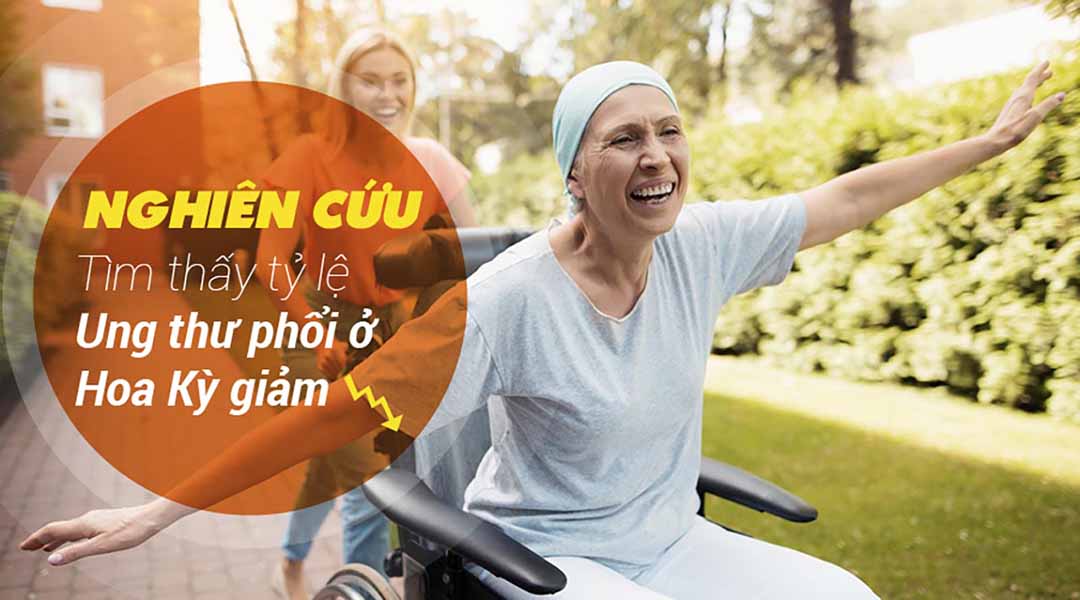 Nghiên cứu tìm thấy tỷ lệ ung thư phổi ở Hoa Kỳ giảm nói chung