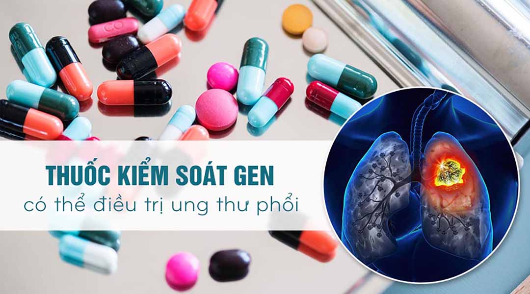 Thuốc kiểm soát gen có thể điều trị ung thư phổi