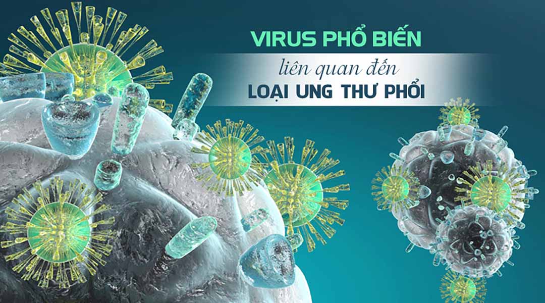 Virus phổ biến liên quan đến loại ung thư phổi