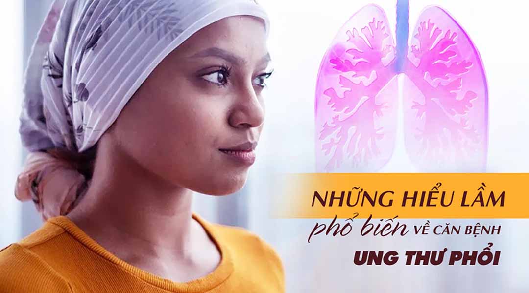 Những hiểu lầm phổ biến về căn bệnh ung thư phổi