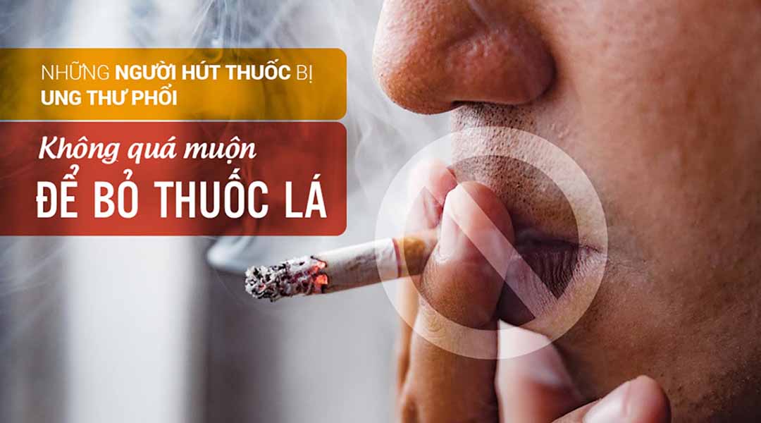 Những người hút thuốc bị ung thư phổi: Không quá muộn để bỏ thuốc lá