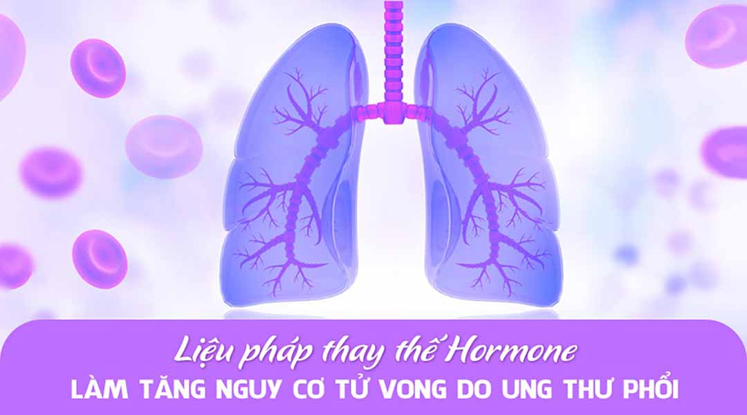 Liệu pháp thay thế hormone làm tăng nguy cơ tử vong do ung thư phổi