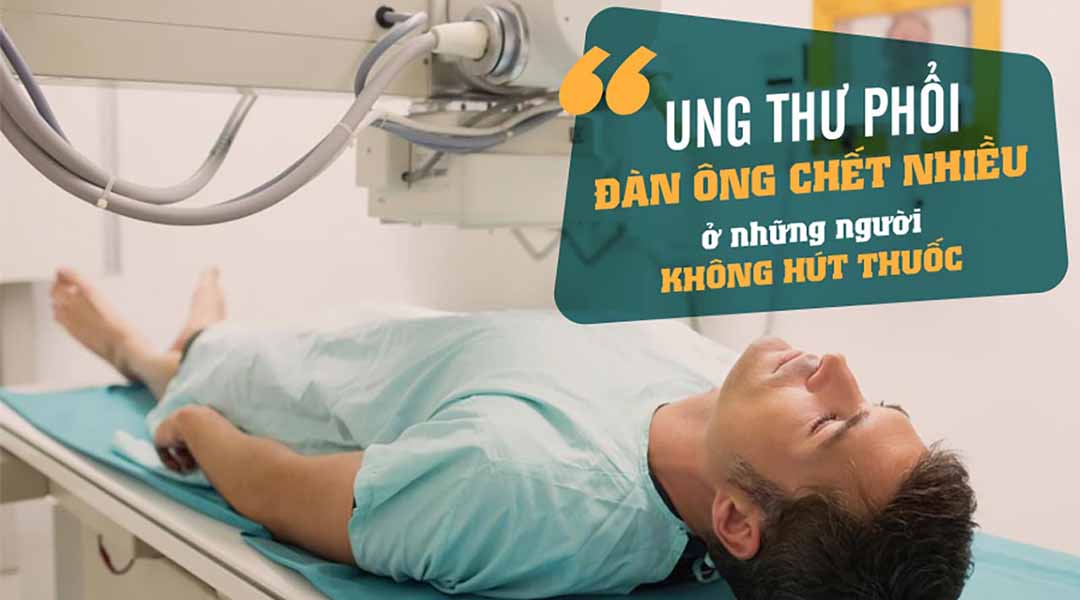 Ung thư phổi ở những người không hút thuốc: Đàn ông chết nhiều hơn