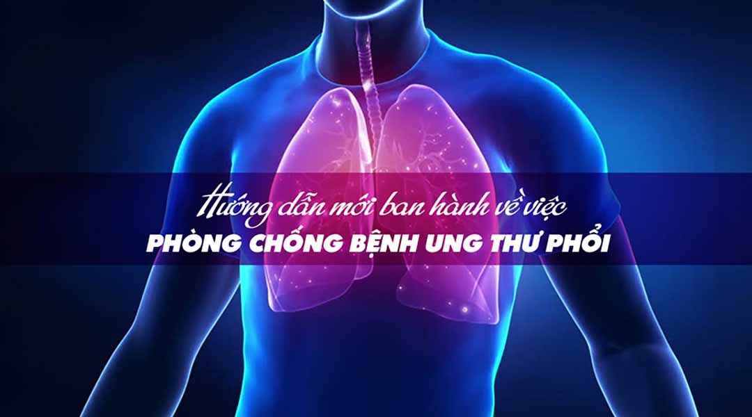 Hướng dẫn mới ban hành về việc phòng chống bệnh ung thư phổi 