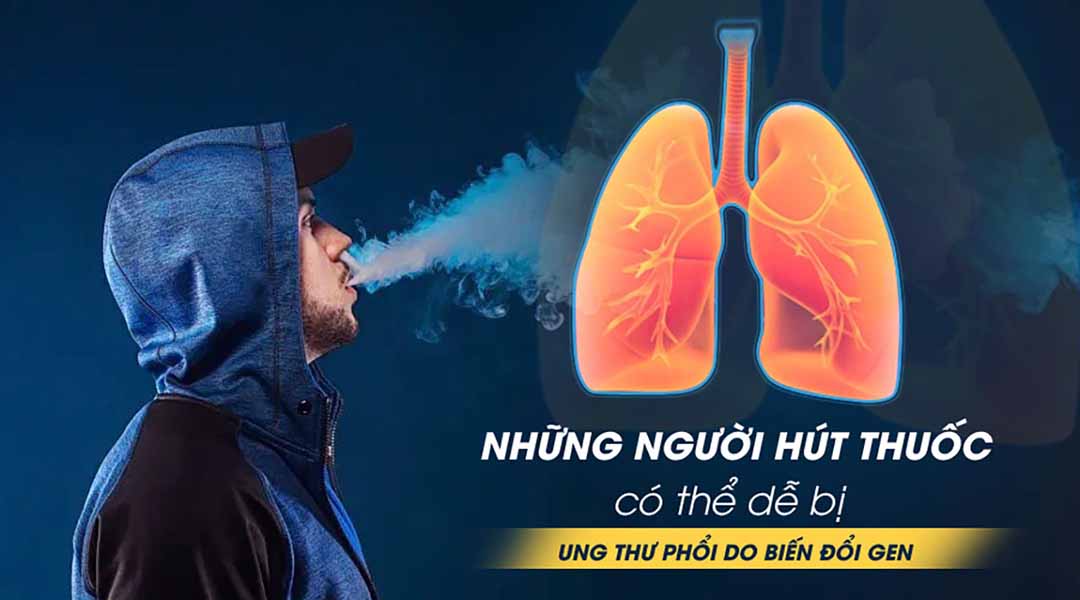 Những người hút thuốc có thể dễ bị ung thư phổi do biến đổi gen