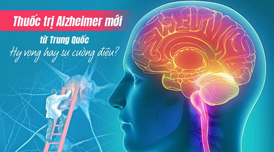 Thuốc trị Alzheimer mới từ Trung Quốc: Hy vọng hay sự cường điệu?