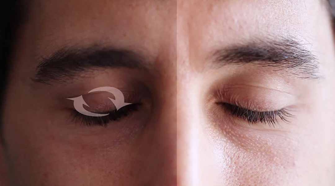REM (Rapid eye movement: giấc ngủ có chuyển động mắt nhanh) và NREM (Non Rapid Eye Movement: giấc ngủ không chuyển động mắt nhanh)