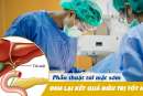 Phẫu thuật túi mật sớm thường đem lại kết quả điều trị tốt hơn