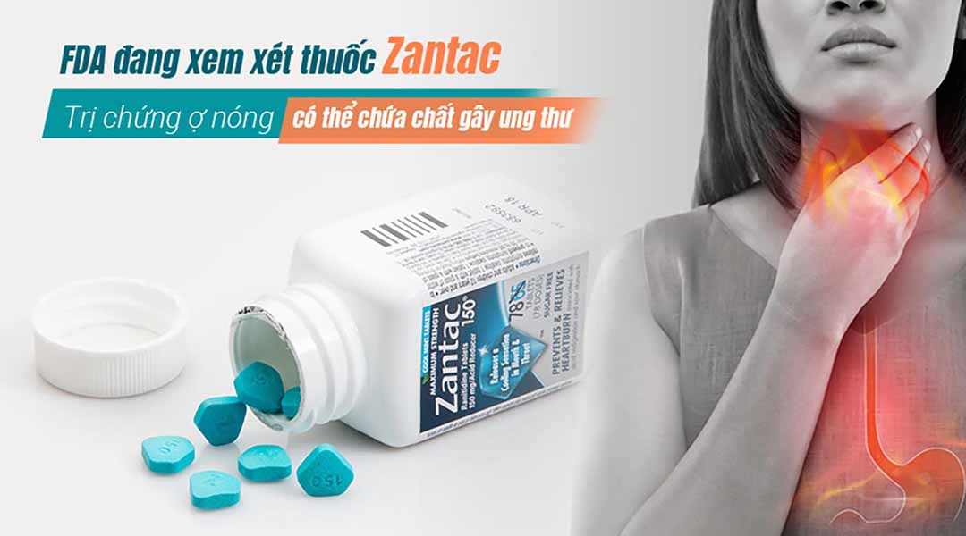 FDA đang xem xét thuốc Zantac trị chứng ợ nóng có thể chứa chất gây ung thư