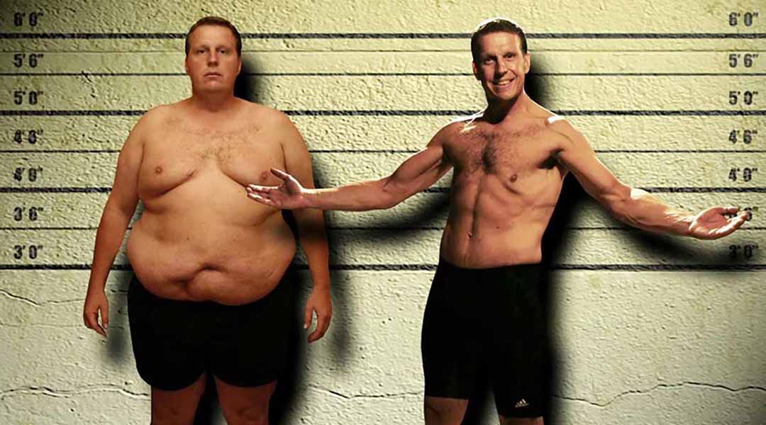 Phẫu thuật giảm cân làm tăng sức khỏe sinh lý nam giới.