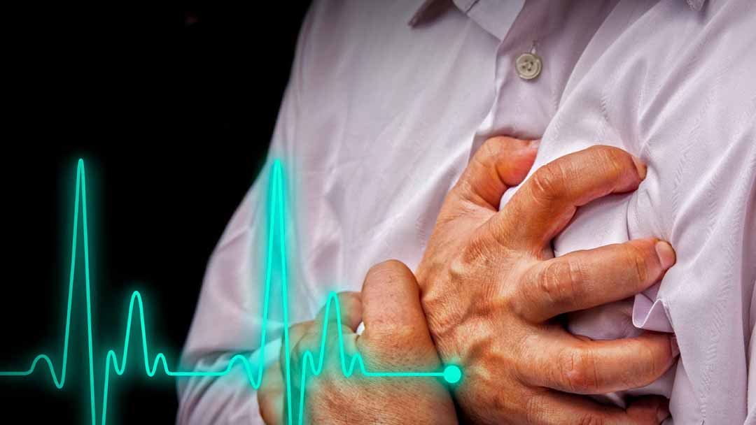 Ngừng tim đột ngột xảy ra khi tim ngừng đập và quá trình tuần hoàn máu bình thường đến não và đi các cơ quan trong cơ thể bị dừng lại.