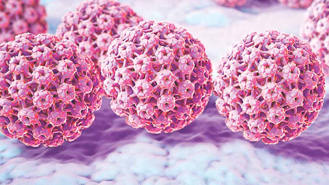 Tầm soát tế bào ung thư cổ tử cung càng sớm, 100% khả năng điều trị khỏi