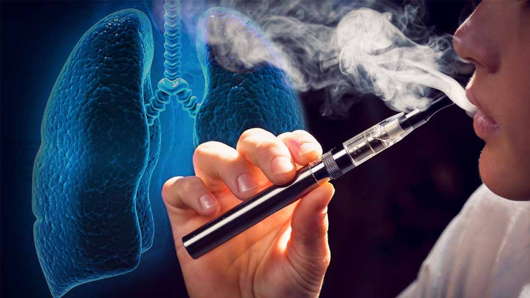 Các bác sĩ phát hiện ra một bệnh phổi mới gắn liền với thuốc lá điện tử