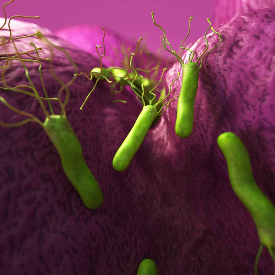 Nhiễm Khuẩn Helicobacter Pylori - HP