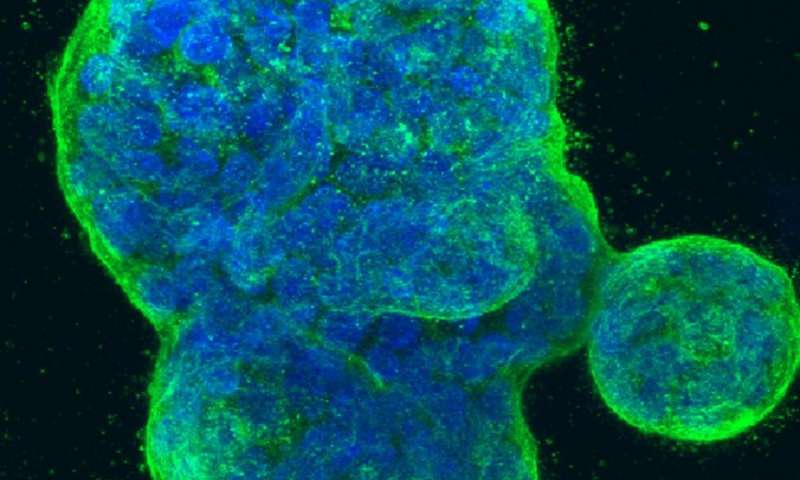 Nuôi cấy tế bào ung thư vú ở người trong ống nghiệm, với DNA nhuộm màu xanh dương và một loại protein trên màng tế bào nhuộm màu xanh lá. Hình ảnh được tạo vào năm 2014 bởi Tom Misteli, Ph.D., và Karen Meaburn, Ph.D. tại NIH IRP.