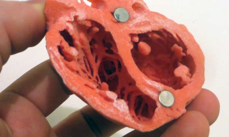 Mô hình 3D về trái tim của Tiến sĩ Matthew Bramlet. Nguồn: NIH