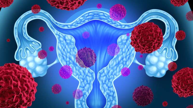 Xác định mạng lưới gen liên quan đến ung thư tử cung có thể dẫn đến các lựa chọn điều trị tốt hơn