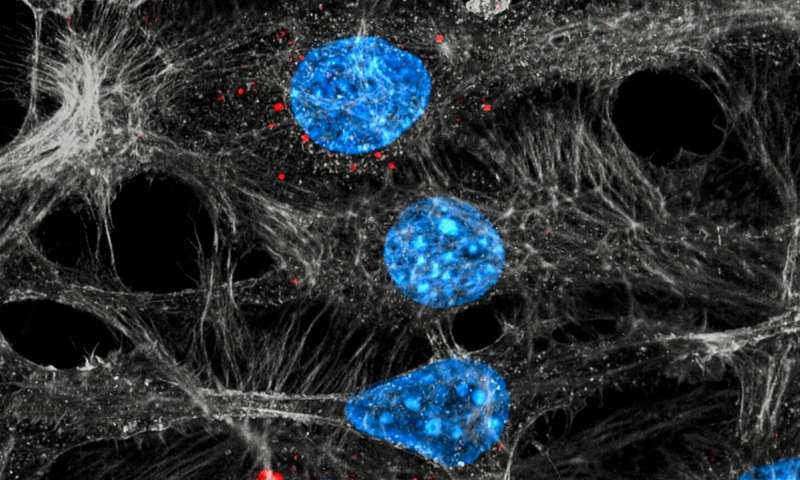 Các tế bào nội mô (màu xanh / xám) exosome nội hóa (màu đỏ) được giải phóng từ các khối u được điều trị bằng hóa trị. Tín dụng: C. Cianciaruso / I. Keklikoglou / EPFL